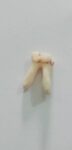 Premolar